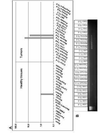 5922159-腫瘍診断と治療のための表面関連抗原の同定 図000035