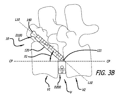 6475762-複数の脊椎外科的経路システムおよび方法 図000035