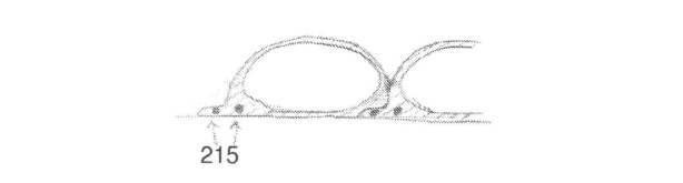 6704891-医療用チューブおよび製造方法 図000036