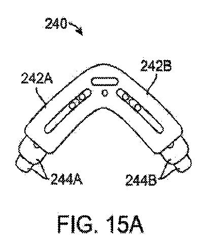 6010545-僧帽弁の修復および置換のためのシステム 図000037