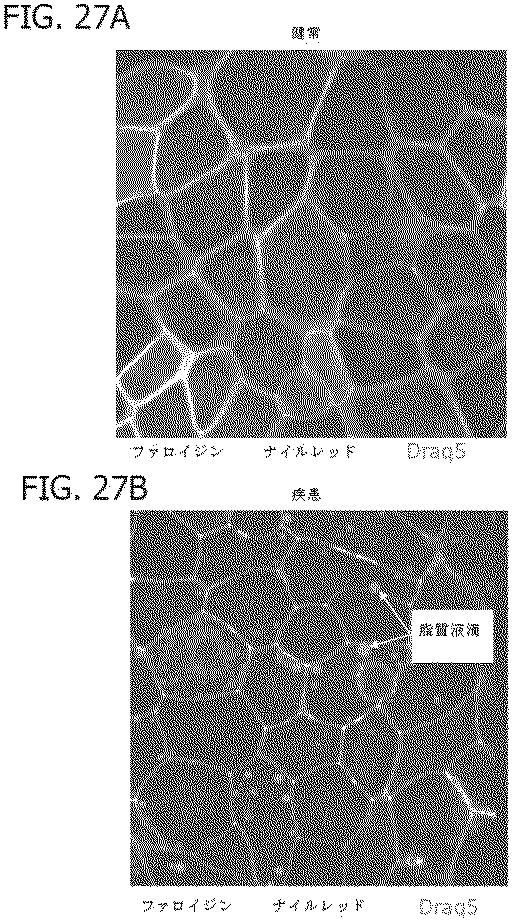 6684706-腫瘍微細環境のための試験管内モデル 図000038