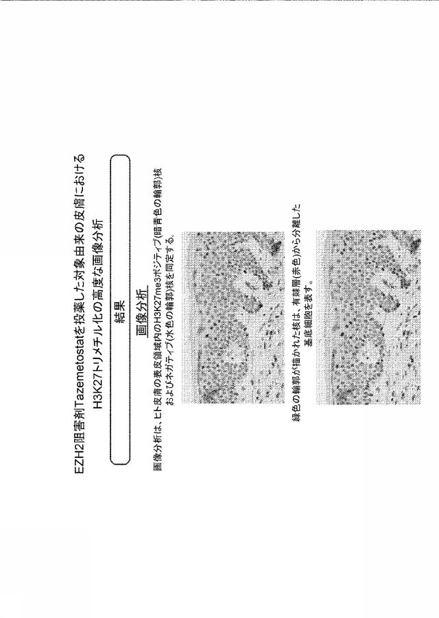 6829684-癌を処置する方法 図000038