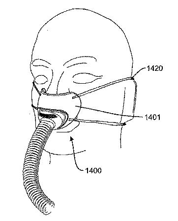 5932113-患者用インターフェースおよびその態様 図000039
