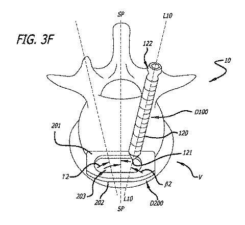 6475762-複数の脊椎外科的経路システムおよび方法 図000039
