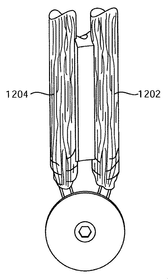 5892446-二重束ＡＣＬ修復システム 図000040