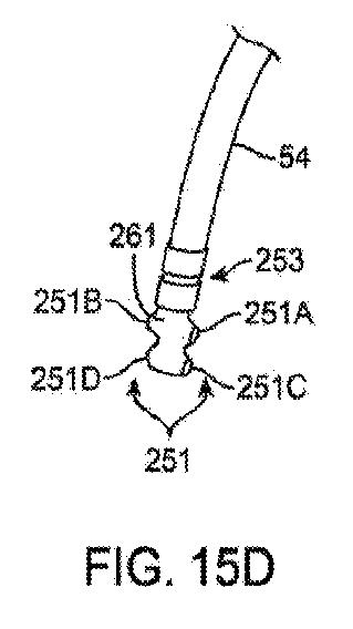 6010545-僧帽弁の修復および置換のためのシステム 図000040