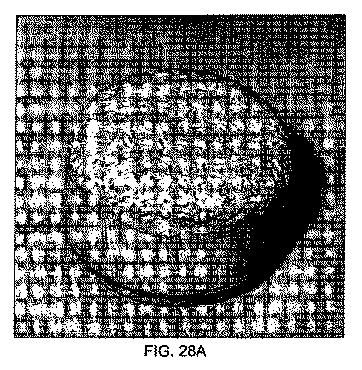 5726536-多孔質生体適合性ポリマー材料および方法 図000041