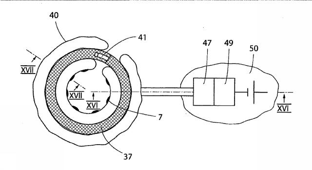 5830513-卵管内の精子の流れを制御する装置 図000041