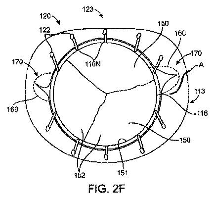 5872692-人工治療装置 図000041