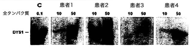 5879374-筋障害を相殺するための手段と方法 図000041