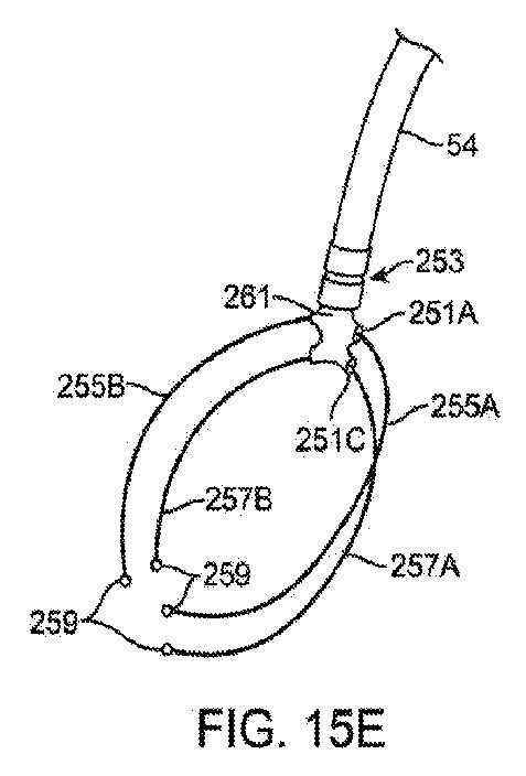 6010545-僧帽弁の修復および置換のためのシステム 図000041