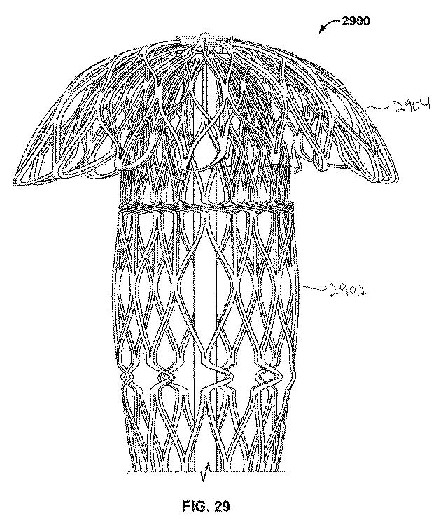 6316876-骨インプラントを固定するための装置および方法 図000041