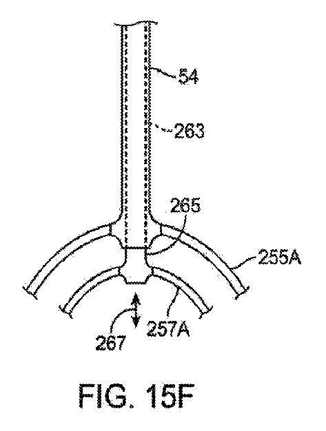 6010545-僧帽弁の修復および置換のためのシステム 図000042