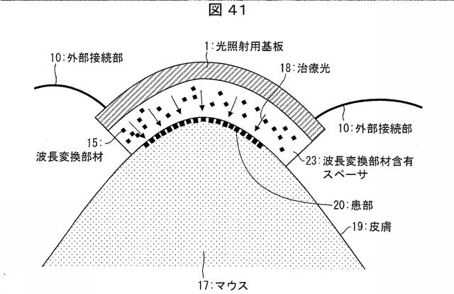 6445187-光照射装置および光治療器 図000042