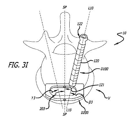 6475762-複数の脊椎外科的経路システムおよび方法 図000042