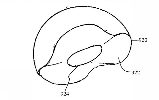 6525582-股関節の面再建 図000042