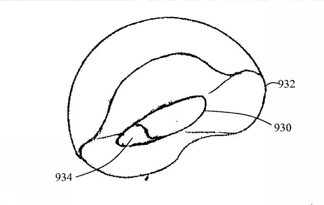 6525582-股関節の面再建 図000043