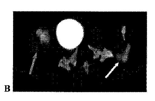 5789821-タンパク質、ペプチドおよび他の分子の改善されたＦ−１８標識化のための方法および組成物 図000044