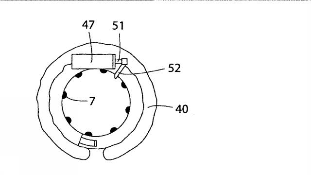 5830513-卵管内の精子の流れを制御する装置 図000044