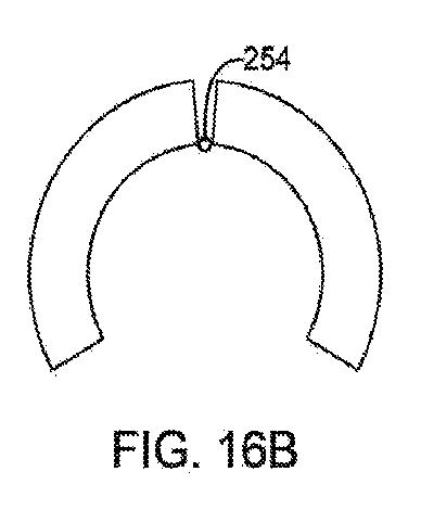 6010545-僧帽弁の修復および置換のためのシステム 図000044