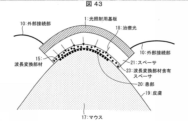 6445187-光照射装置および光治療器 図000044