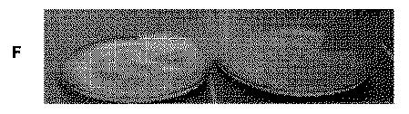 5819303-安定化された液体および凍結乾燥ＡＤＡＭＴＳ１３製剤 図000045