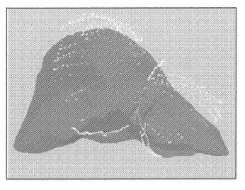 6283672-画像誘導処置中の変形のためにデータを修正する向上された方法 図000045