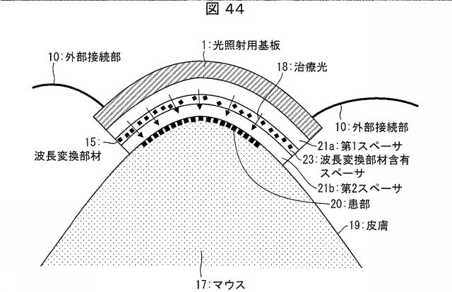 6445187-光照射装置および光治療器 図000045