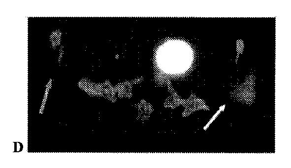 5789821-タンパク質、ペプチドおよび他の分子の改善されたＦ−１８標識化のための方法および組成物 図000046