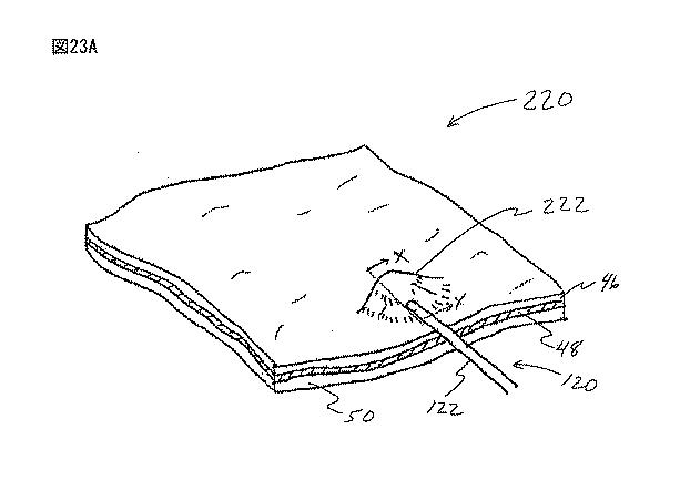 6235672-粘膜下医療処置を実行するための方法及びシステム 図000046