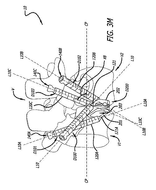 6475762-複数の脊椎外科的経路システムおよび方法 図000046