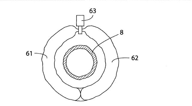 5830513-卵管内の精子の流れを制御する装置 図000047