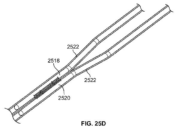 6606570-瘻を形成するためのデバイスおよび方法 図000047