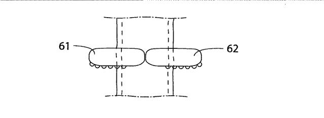 5830513-卵管内の精子の流れを制御する装置 図000048