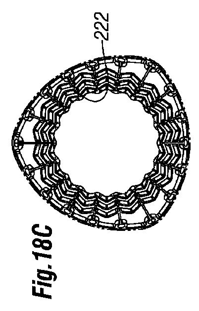 5647680-一体的な迅速接続人工心臓弁ならびに配備のシステムおよび方法 図000049