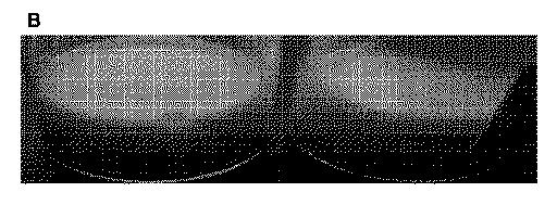 5819303-安定化された液体および凍結乾燥ＡＤＡＭＴＳ１３製剤 図000049