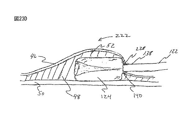 6235672-粘膜下医療処置を実行するための方法及びシステム 図000049