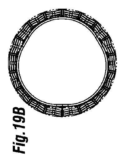 5647680-一体的な迅速接続人工心臓弁ならびに配備のシステムおよび方法 図000051