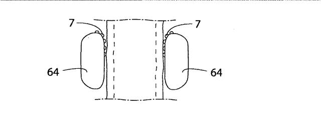 5830513-卵管内の精子の流れを制御する装置 図000051