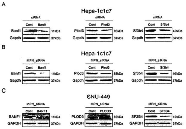 6967810-肝癌の予防または治療用の薬学的組成物 図000051