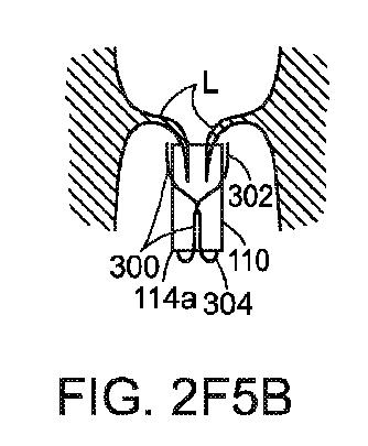 5872692-人工治療装置 図000052