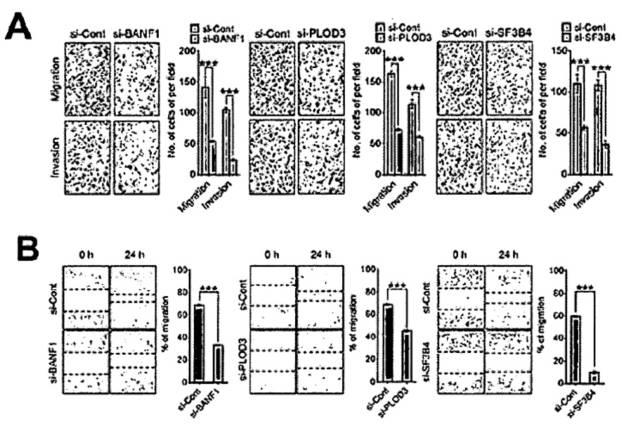 6967810-肝癌の予防または治療用の薬学的組成物 図000052