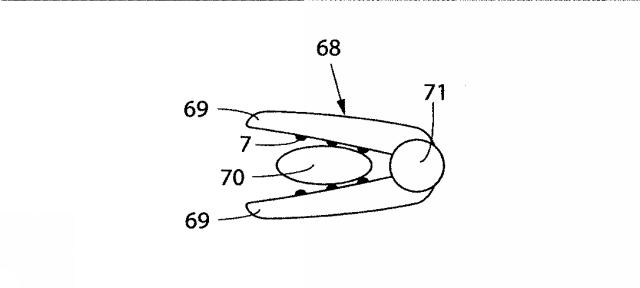 5830513-卵管内の精子の流れを制御する装置 図000053