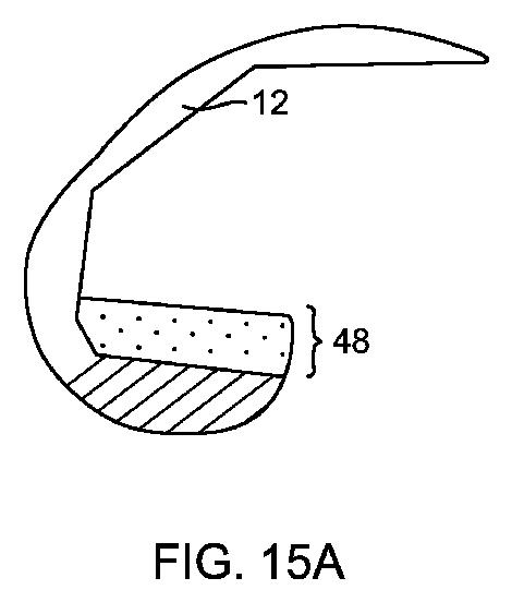 5837876-人工膝患者に深膝屈曲能力を提供するシステム及び方法 図000054