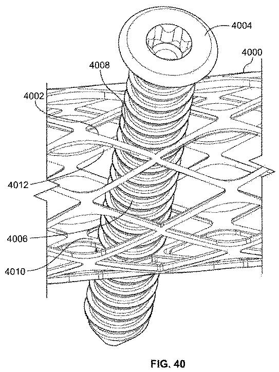 6316876-骨インプラントを固定するための装置および方法 図000054