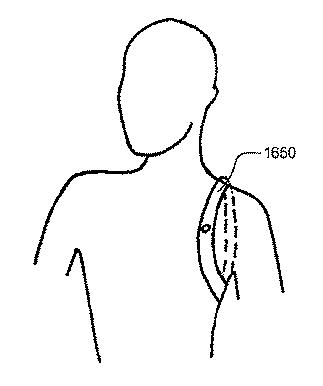 6909140-患者用インターフェースおよびその態様 図000054