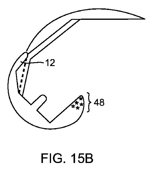 5837876-人工膝患者に深膝屈曲能力を提供するシステム及び方法 図000055