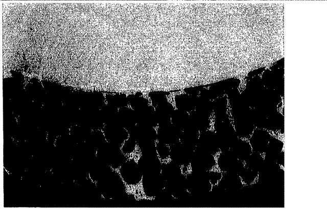 5916989-異なる質感を有する表面を備えた人工関節及びその人工関節の作製方法 図000055