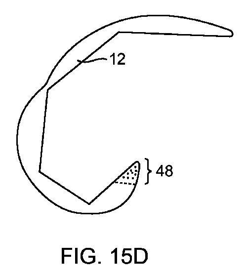 5837876-人工膝患者に深膝屈曲能力を提供するシステム及び方法 図000057