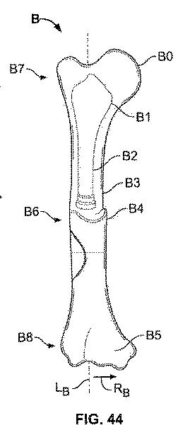 6316876-骨インプラントを固定するための装置および方法 図000058